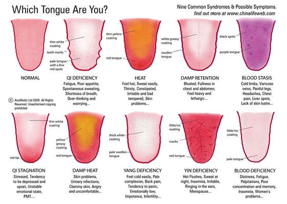 examples of different tongues, tongue diagnosis